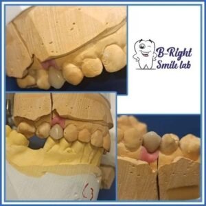 B-Right Smile Lab